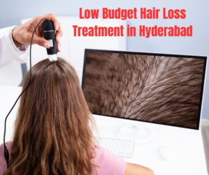 Low Budget Hair Loss Treatment in Hyderabad