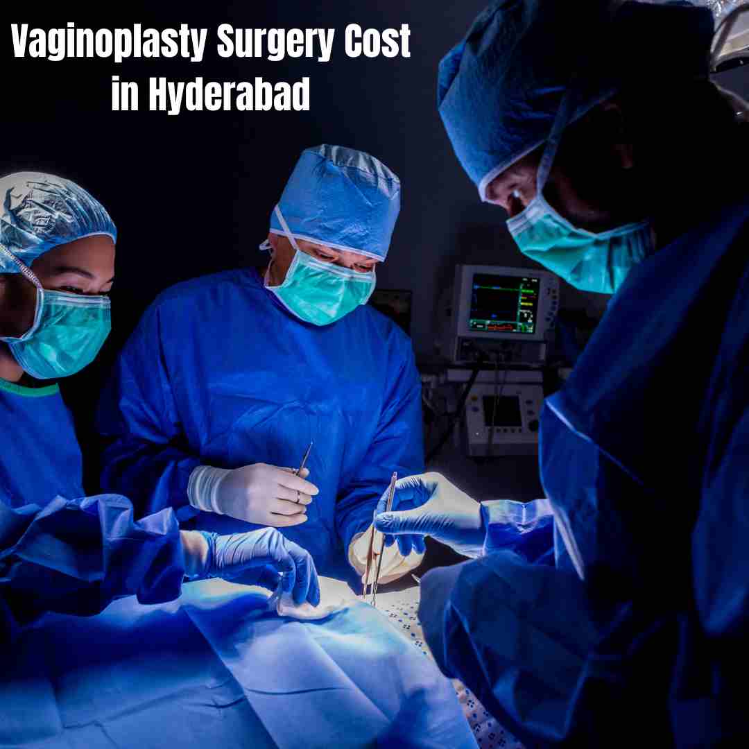 Vaginoplasty Surgery Cost in Hyderabad